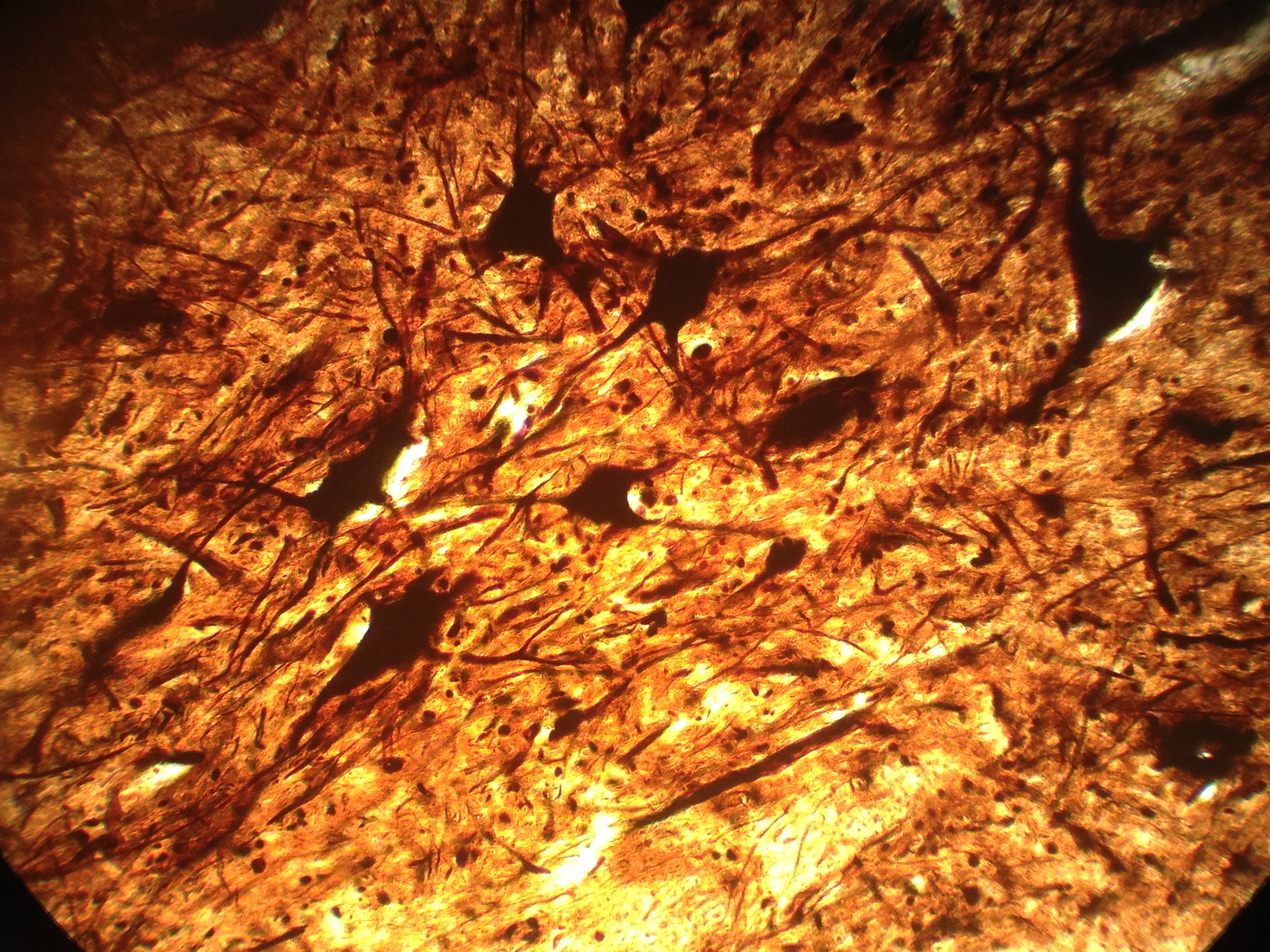 Spinal cord neuron stain