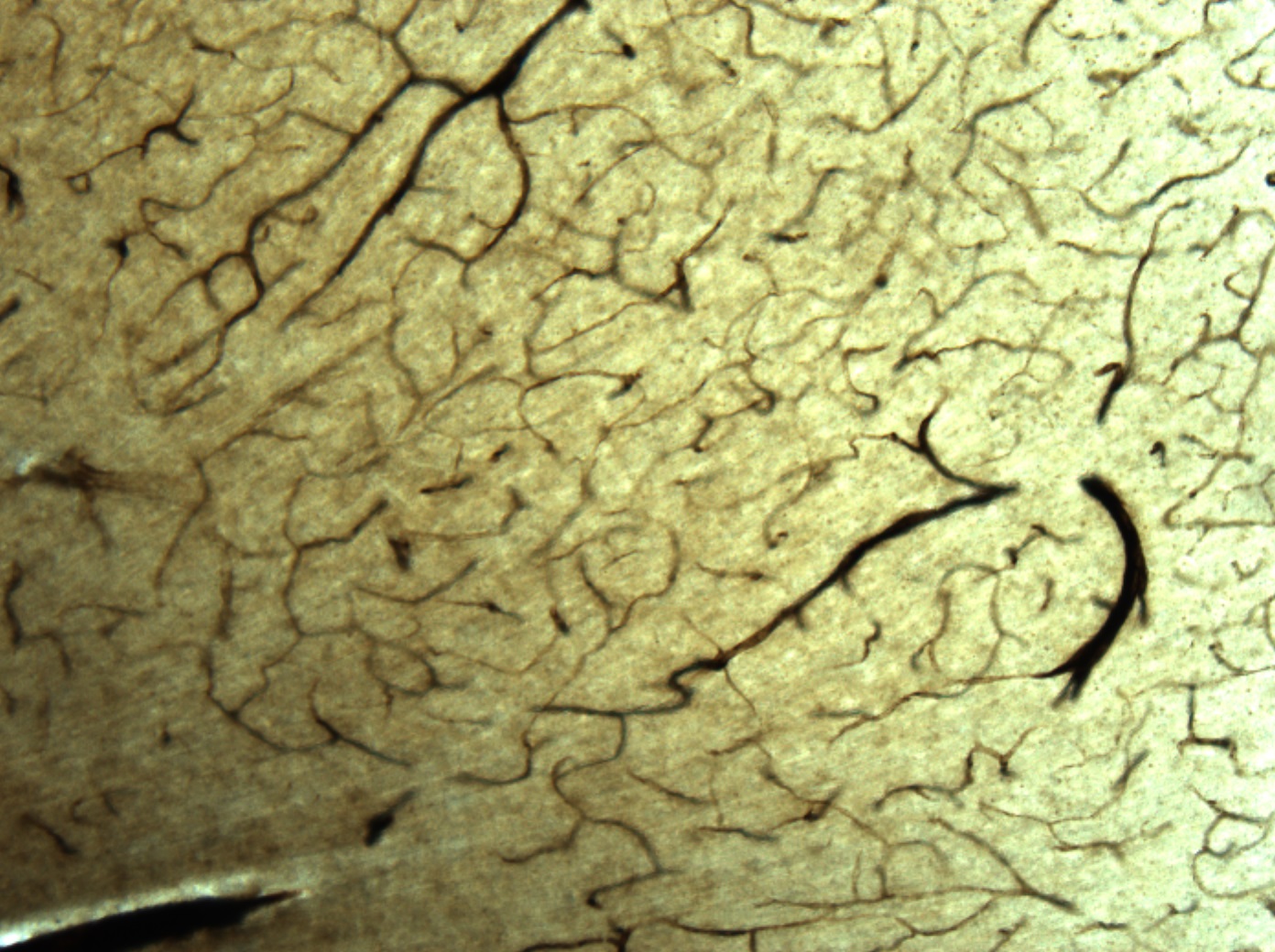 Cerebral microvasculature stain